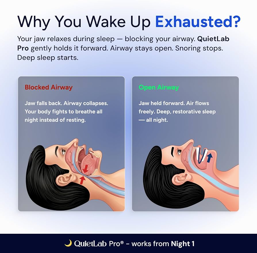QuietLab Pro Anti-Snoring Mouthpiece – Adjustable Night Guard for Snoring Relief, No-Boil Custom Fit, Orthodontist-Designed, BPA-Free Medical Grade Material